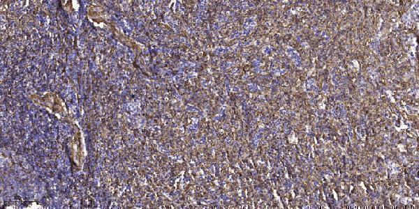 Immunohistochemical analysis of paraffin-embedded human spleen tissue