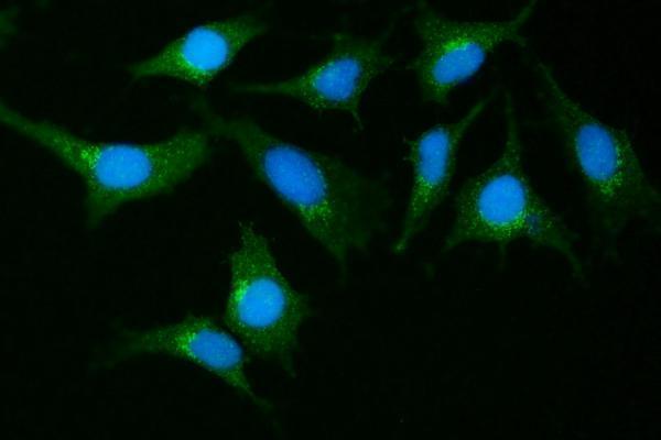 a02140 3 git1 primary antibodies if testing 9