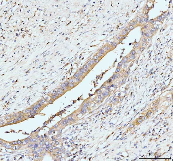  IHC analysis of GIT1 using anti-GIT1 antibody (A02140-3)