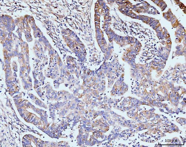 a02140 3 git1 primary antibodies ihc testing 4