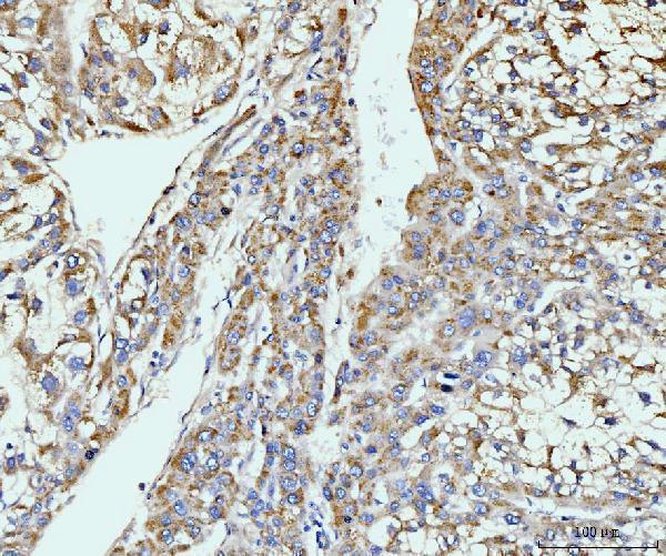 a02140 3 git1 primary antibodies ihc testing 5