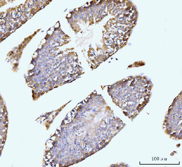 a02140 3 git1 primary antibodies ihc testing 7