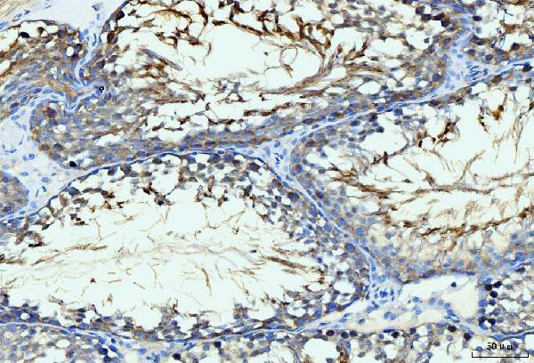 a02140 3 git1 primary antibodies ihc testing 8