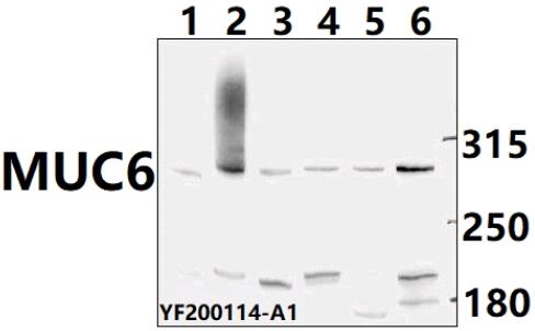 Western blot (WB) analysis of MUC6 pAb at 1:500 dilution
Lane1:HCT116 whole cell lysate(40ug)
Lane2:Aml-12 whole cell lysate(40ug)
Lane3:Hela whole cell lysate(40ug)
Lane4:A2780 whole cell lysate(40ug)                                  
Lane5:The Fallopian tube tissue lysate of Mouse(40ug)                                            Lane6:HepG2 whole cell lysate (40ug)