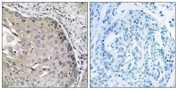 a02144 1 aox1 primary antibodies ihc testing 1