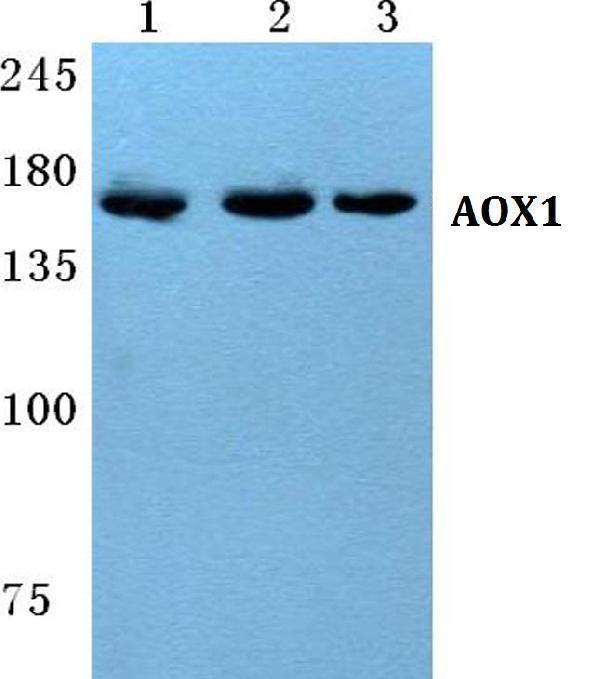 Western blot (WB) analysis of AOX1 polyclonal antibody at 1:500 dilution
Lane1:MCF-7 cell lysate
Lane2:sp2/0 cell lysate
Lane3:PC12 cell lysate