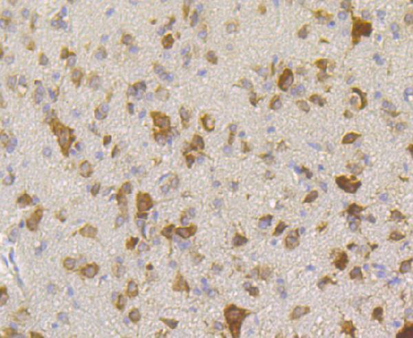 Immunohistochemical analysis of paraffin-embedded rat cerebellum tissue using anti-RACK1 antibody