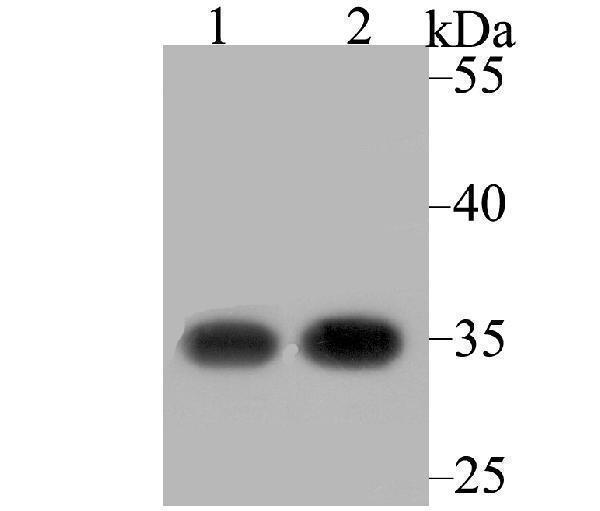 Western blot analysis of RACK1 on different lysates using anti-RACK1 antibody at 1/2,000 dilution