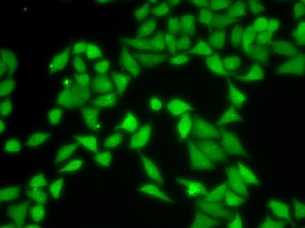 Immunofluorescence analysis of MCF-7 cells using RACK1 antibody 