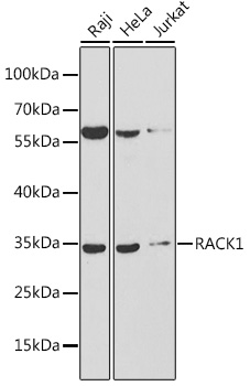Western blot analysis of extracts of various cell lines, using RACK1 antibody  at 1:1000 dilution