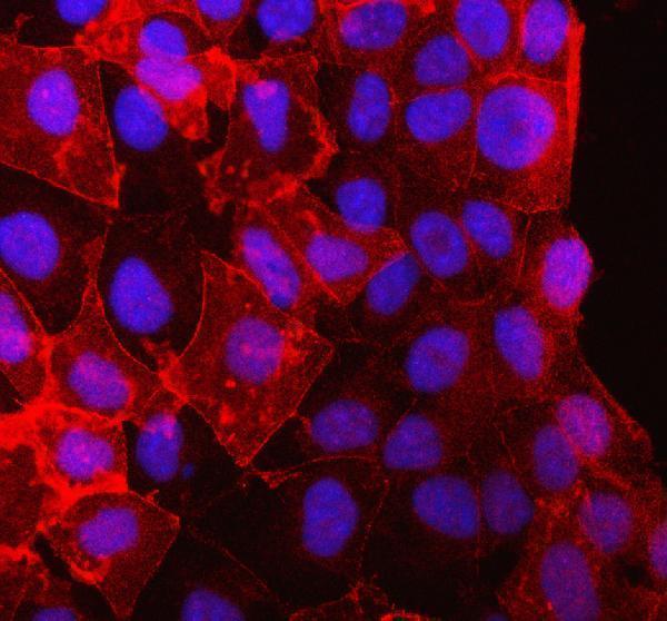 a02146 1 pkp2 primary antibodies if testing 1