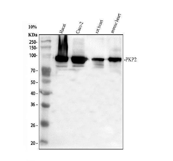 a02146 1 pkp2 primary antibodies wb testing 1_1