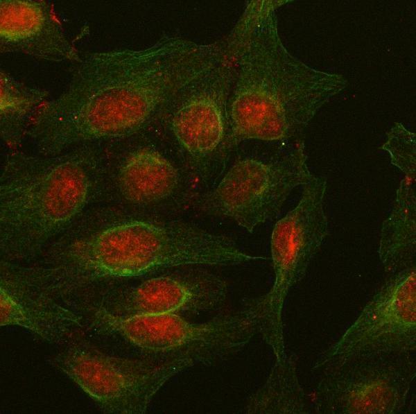 a02146 2 pkp2 primary antibodies if testing 8