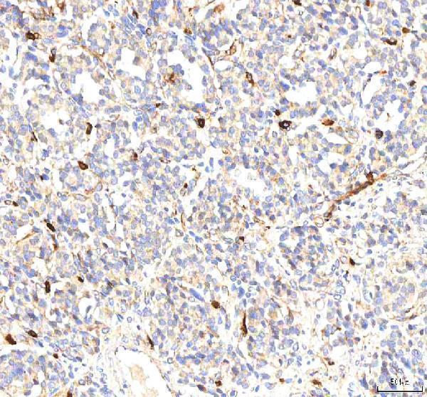 a02146 2 pkp2 primary antibodies ihc testing 2