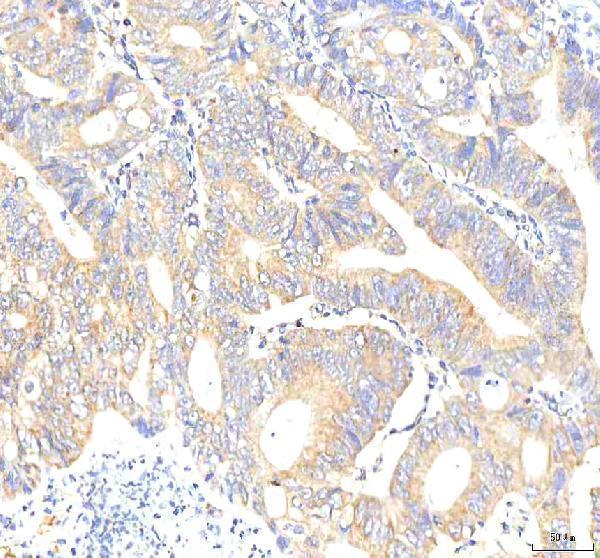 a02146 2 pkp2 primary antibodies ihc testing 3