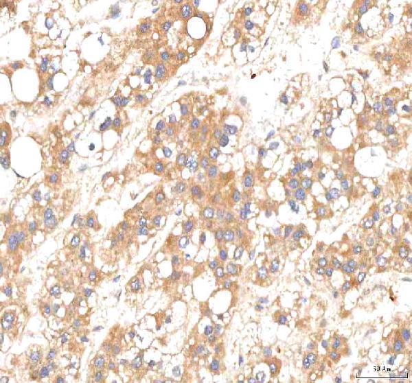 a02146 2 pkp2 primary antibodies ihc testing 4