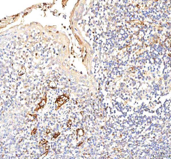 a02146 2 pkp2 primary antibodies ihc testing 5