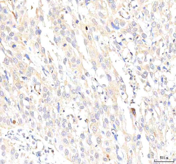 a02146 2 pkp2 primary antibodies ihc testing 6