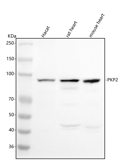 a02146 2 pkp2 primary antibodies wb testing 1