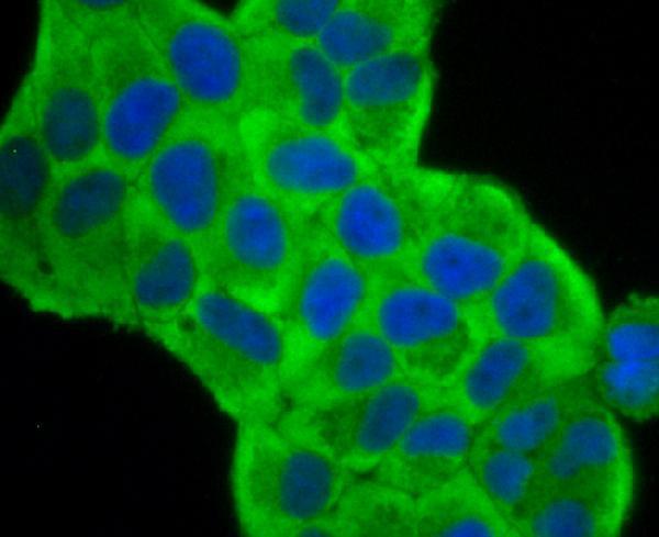 a02147 1 fscn1 primary antiboties icc testing 2