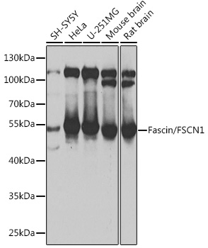 Western blot analysis of extracts of various cell lines, using Fascin/Fascin/FSCN1 antibody  at 1:1000 dilution