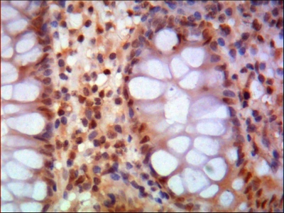 a02148 2 smc1a primary antibodyes ihc testing 1