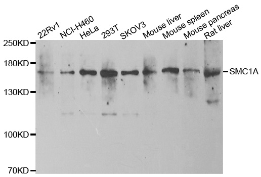 a02148 3 smc1a primary antiboties wb testing 1