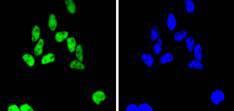 a02148 4 smc1a primary antiboties icc testing 2