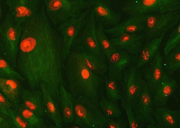 a02148 5 smc1a primary antibodies if testing 2