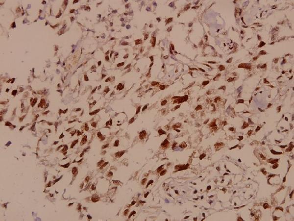 a02148s951 smc1a primary antiboties ihc testing 2