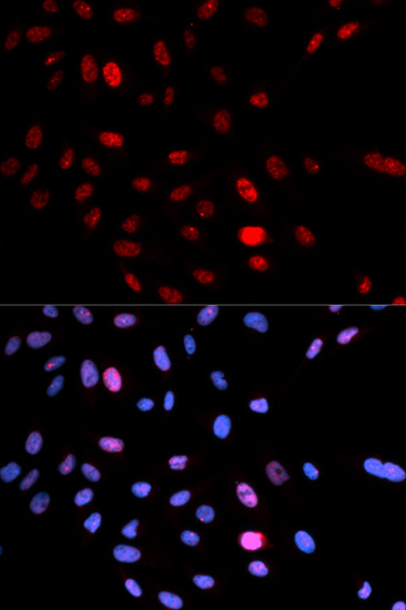a02148s957 1 smc1a primary antiboties ihc testing 3