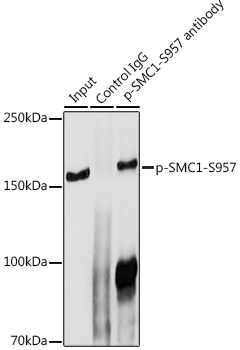 a02148s957 1 smc1a primary antiboties ip testing 4