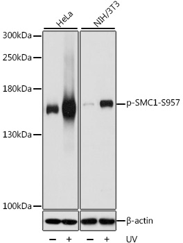 a02148s957 1 smc1a primary antiboties wb testing 1