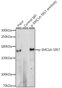 a02148s957 1 smc1a primary antiboties wb testing 2