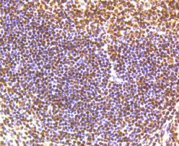 a02148s957 2 smc1a primary antiboties ihc testing 2