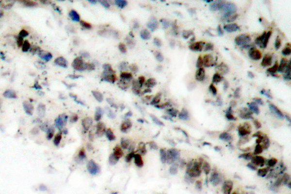 a02148s957 smc1a primary antiboties ihc testing 2