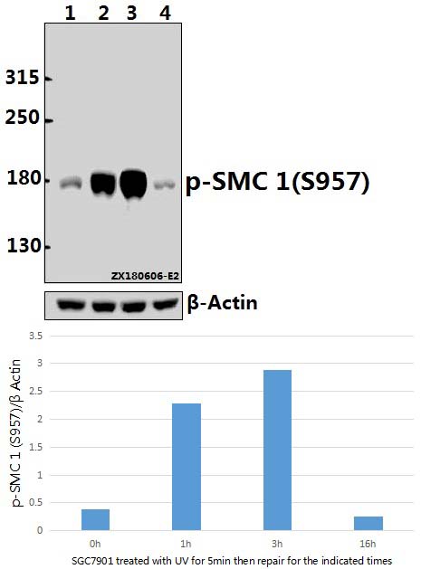 a02148s957 smc1a primary antiboties wb testing 1