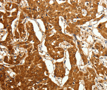 Immunohistochemistry (IHC) analysis of CDH23 polyclonal antibody