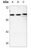 Western blot analysis of Cadherin 23 expression in HEK293T (A), A549 (B), 
PC12 (C) whole cell lysates