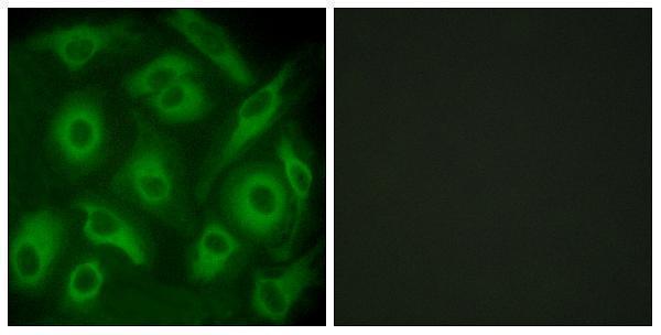 Immunofluorescence analysis of HeLa cells, using CDH23 Antibody
