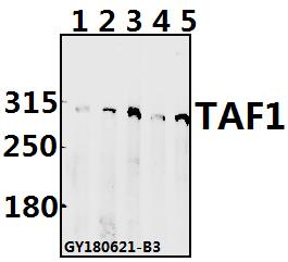 Western blot (WB) analysis of TAF1 pAb at 1:500 dilution
Lane1:HepG2 whole cell lysate(40ug)
Lane2:L02 whole cell lysate(40ug)
Lane3:H1792 whole cell lysate(40ug)
Lane4:AML-12 whole cell lysate(40ug)
Lane5:C6 whole cell lysate(40ug)