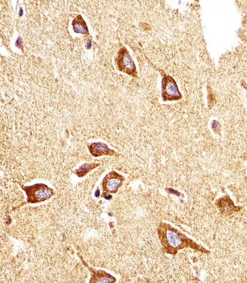 Immunohistochemical analysis of paraffin-embedded H