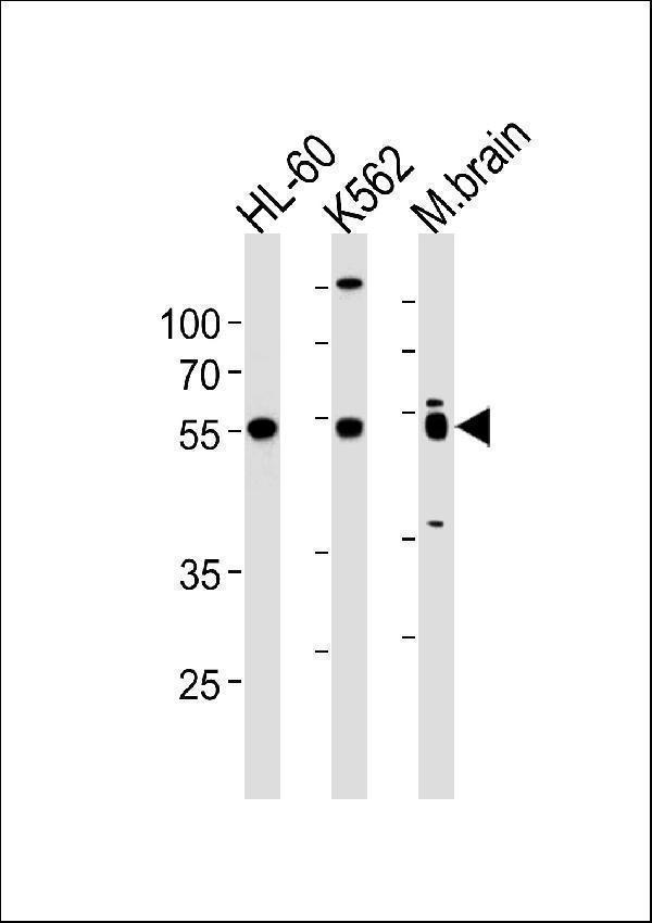 PTGER4 Antibody (Center) western blot analysis in HL-60,K562 cell line and mouse brain lysates (35ug/lane)