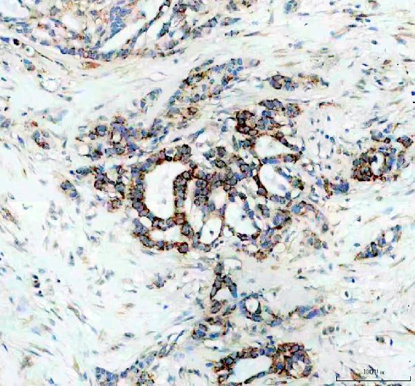 IHC analysis of CKAP4 using anti-CKAP4 antibody (A02154-2)