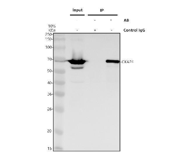 a02154 2 ckap4 primary antibodies ip testing 1