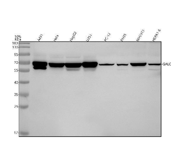 Western blot analysis of CKAP4 using anti-CKAP4 antibody (A02154-2)