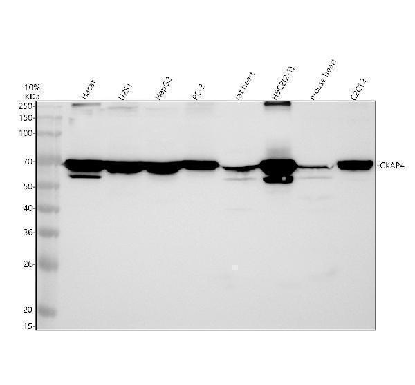 Western blot analysis of CKAP4 using anti-CKAP4 antibody (A02154-2)