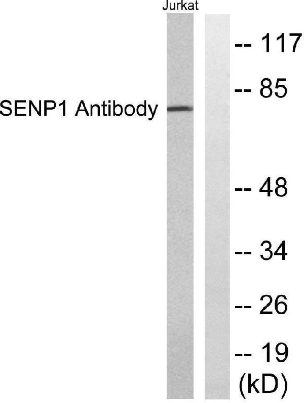 Western blot analysis of lysates from Jurkat cells, using SENP1 Antibody
