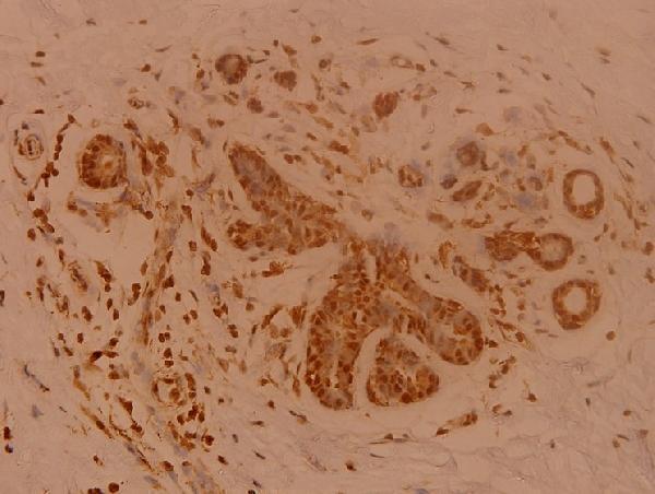 a02156 2 senp1 primary antiboties ihc testing 2