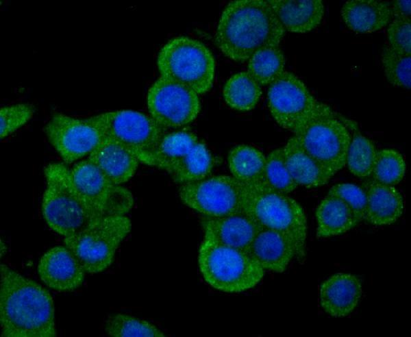 ICC staining SENP1 in LOVO cells (green)